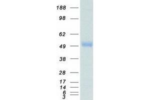 Western Blotting (WB) image for Microtubule-Associated Protein tau (MAPT) (Transcript Variant 2) protein (Myc-DYKDDDDK Tag) (ABIN2725487)