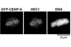 Immunofluorescent staining of mitotic Hela cell line stably expressing a GFP-CENP-A fusion protein followed by antibody against EGFP (left).