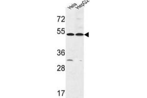 Western Blotting (WB) image for anti-Fermitin Family Member 1 (FERMT1) antibody (ABIN3003961) (FERMT1 Antikörper)