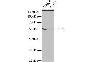 Western blot analysis of extracts of various cell lines, using SGCE antibody. (SGCE Antikörper)