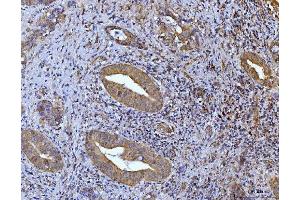 IHC analysis of Glutaminase/GLS using anti-Glutaminase/GLS antibody (ABIN7601602).