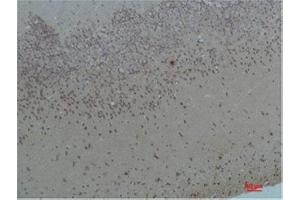 Immunohistochemistry (IHC) analysis of paraffin-embedded Rat Brain Tissue using Bombesin Receptor 2 Rabbit Polyclonal Antibody diluted at 1:200. (Bombesin Receptor 2 Antikörper)