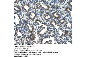 Rabbit Anti-RPL8 Antibody  Paraffin Embedded Tissue: Human Lung Cellular Data: Alveolar cells Antibody Concentration: 4.