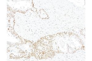 Immunohistochemistry (IHC) image for anti-Bloom Syndrome RecQ Like Helicase (BLM) (C-Term) antibody (ABIN7795726)