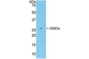 Detection of Recombinant Grb7, Mouse using Polyclonal Antibody to Growth Factor Receptor Bound Protein 7 (Grb7) (GRB7 Antikörper  (AA 298-489))