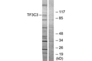 Western blot analysis of extracts from 293 cells, using TF3C3 Antibody.