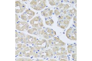 Immunohistochemistry of paraffin-embedded human stomach using BGLAP antibody (ABIN5975009) at dilution of 1/100 (40x lens). (Osteocalcin Antikörper)