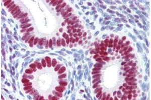 Immunohistochemistry (Paraffin-embedded Sections) (IHC (p)) image for anti-Progesterone Receptor (PGR) (C-Term) antibody (ABIN364377)