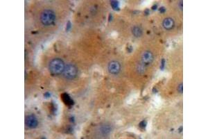 Used in DAB staining on fromalin fixed paraffin-embedded Liver tissue (IGF2 Antikörper  (AA 25-91))