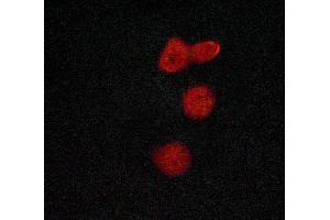ABIN6269067 staining Hela cells by ICC/IF. (MSK1 Antikörper  (Internal Region))