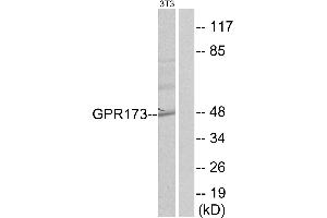 Western blot analysis of extracts from NIH-3T3 cells, using GPR173 antibody. (GPR173 Antikörper  (Internal Region))