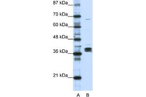 WB Suggested Anti-HNRPDL Antibody Titration:  1.