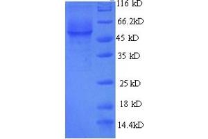 SDS-PAGE (SDS) image for Galactosidase, alpha (GLA) (AA 1-432), (full length) protein (His tag) (ABIN5714290) (GLA Protein (AA 1-432, full length) (His tag))