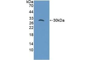 Detection of Recombinant GAB3, Mouse using Polyclonal Antibody to GRB2 Associated Binding Protein 3 (GAB3) (GAB3 Antikörper  (AA 142-375))