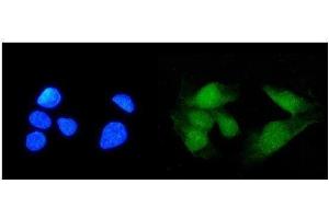 IF analysis of TRIM21/SS-A using anti-TRIM21/SS-A antibody (ABIN7599820). (TRIM21 Antikörper  (AA 12-475))