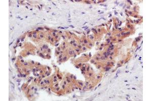Immunohistochemistry (Paraffin-embedded Sections) (IHC (p)) image for anti-Glucosaminyl (N-Acetyl) Transferase 2, I-Branching Enzyme (I Blood Group) (GCNT2) (AA 151-250) antibody (ABIN1713810)