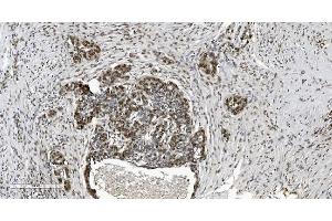 IHC analysis of HP1 alpha/CBX5 using anti-HP1 alpha/CBX5 antibody (ABIN7599057). (CBX5 Antikörper  (AA 1-191))