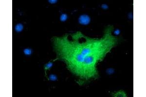 Anti-L1CAM mouse monoclonal antibody (ABIN2453223) immunofluorescent staining of COS7 cells transiently transfected by pCMV6-ENTRY L1CAM (RC211601). (L1CAM Antikörper)
