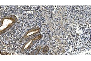 IHC analysis of NOX2/gp91phox/CYBB using anti-NOX2/gp91phox/CYBB antibody (ABIN7599875). (CYBB Antikörper  (AA 124-559))