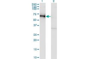 Western Blot analysis of GOLM1 expression in transfected 293T cell line by GOLM1 monoclonal antibody (M06), clone 5B10.