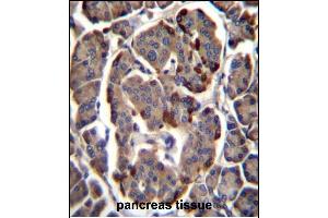RAB11B Antibody (C-term) (ABIN1881719 and ABIN2846071) immunohistochemistry analysis in formalin fixed and paraffin embedded human pancreas tissue followed by peroxidase conjugation of the secondary antibody and DAB staining. (RAB11B Antikörper  (C-Term))