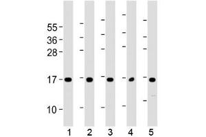 Western blot testing of human 1) 293T/17, 2) HUVEC, 3) K562, 4) NCI-H460 and 5) PC-3 cell lysate with Eotaxin-3 antibody at 1:2000. (CCL26 Antikörper  (AA 58-92))