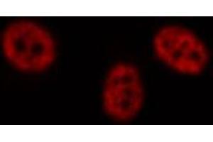 ABIN6269156 staining HeLa by IF/ICC. (RPA2 Antikörper  (N-Term))
