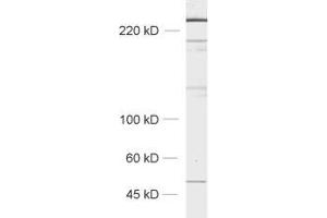 dilution: 1 : 1000, sample: rat brain homogenate