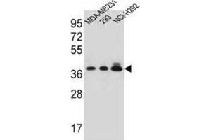Western Blotting (WB) image for anti-Taste Receptor, Type 2, Member 1 (TAS2R1) antibody (ABIN2997059) (TAS2R1 Antikörper)