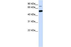 SMARCD1 antibody used at 1 ug/ml to detect target protein. (SMARCD1 Antikörper  (Middle Region))