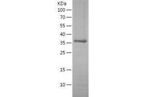 Western Blotting (WB) image for DNA Repair Protein Homolog 1 (RAD51) (AA 2-339) protein (His tag) (ABIN7122684)