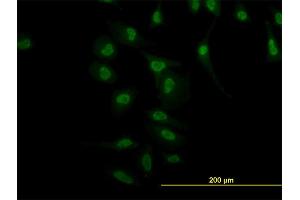 Immunofluorescence of monoclonal antibody to NR4A2 on HeLa cell.