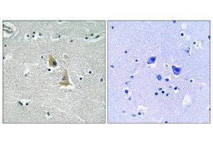Immunohistochemistry (IHC) image for anti-Neutrophil Cytosol Factor 1 (NCF1) (Ser345) antibody (ABIN1848360) (NCF1 Antikörper  (Ser345))