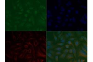 Immunofluorescence of Anti-Histone H3 K37 me3: Histone H3 trimethyl Lys37 antibody was tested at 1:100,000 in HeLa cells with FITC (green). (Histone 3 Antikörper  (3meLys37))