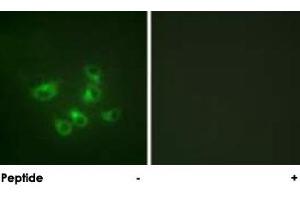 Immunofluorescence analysis of HepG2 cells, using TPH1 polyclonal antibody . (Tryptophan Hydroxylase 1 Antikörper  (AA 25-75))