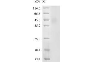 Adhesion G Protein-Coupled Receptor G1 (ADGRG1) (AA 26-382) protein (His tag)
