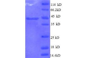 SDS-PAGE (SDS) image for Interleukin 10 (IL10) (AA 19-178) protein (GST tag) (ABIN5712490)