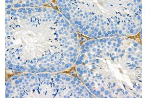 ABIN6263482 and ABIN6279565 at 1/100 staining Mouse testis tissue by IHC-P. (MYO5C Antikörper  (Internal Region))