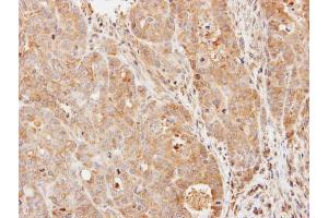 IHC-P Image Immunohistochemical analysis of paraffin-embedded N87 xenograft, using PDE9A, antibody at 1:500 dilution.