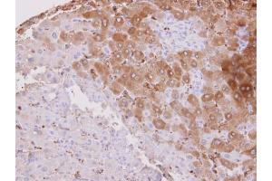 IHC-P Image HSD3B2 antibody detects HSD3B2 protein at cytosol on human normal liver by immunohistochemical analysis.
