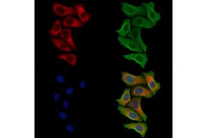 anti-Phospholamban (PLN) antibody