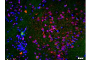 Formalin-fixed and paraffin embedded rat brain labeled with Anti-Histone H3 (Di Methyl K9) Polyclonal Antibody, Unconjugated (ABIN703886) at 1:200 followed by conjugation to the secondary antibody Goat Anti-Rabbit IgG, Cy3 conjugated used at 1:200 dilution for 40 minutes at 37 °C and DAPI staining