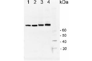 Image no. 2 for anti-Heat Shock Protein 70 (HSP70) (Cytoplasmic) antibody (ABIN334584) (HSP70 Antikörper  (Cytoplasmic))
