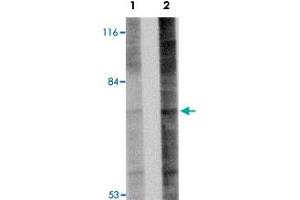Western blot analysis of Gle1 in 293 cell lysate with Gle1 polyclonal antibody  at (A) 1 and (B) 2 ug/mL . (GLE1 Antikörper  (Internal Region))