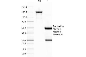SDS-PAGE Analysis Purified vWF Monoclonal Antibody (VWF/1767). (VWF Antikörper  (AA 1815-1939))