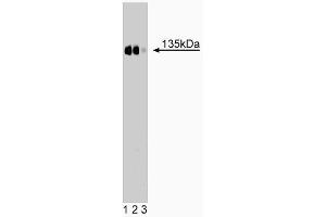 Western blot analysis of CD49c (integrin alpha3) on a rat kidney lysate.