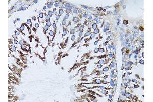 Immunohistochemistry of paraffin-embedded rat liver using β-actin antibody.