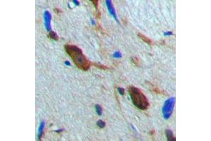 Immunohistochemical analysis of MSK1 staining in human brain formalin fixed paraffin embedded tissue section. (MSK1 Antikörper  (Center))