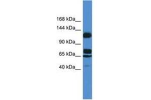 Image no. 1 for anti-Suppression of Tumorigenicity 5 (ST5) (AA 387-436) antibody (ABIN6746819) (ST5 Antikörper  (AA 387-436))