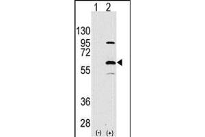 Western blot analysis of ELP3(arrow) using rabbit polyclonal ELP3 Antibody (N-term) (ABIN387966 and ABIN2844714). (ELP3/KAT9 Antikörper  (N-Term))